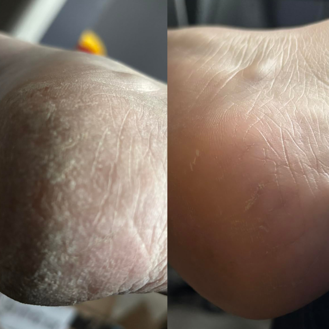 HeloSoft™ Gel Heel Socks