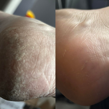 HeloSoft™ Gel Heel Socks