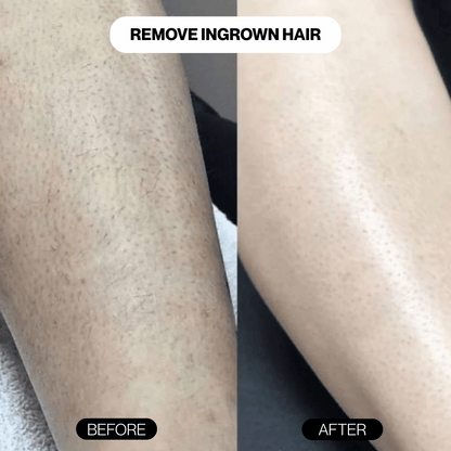 CrystalSmooth™ Hair Eraser