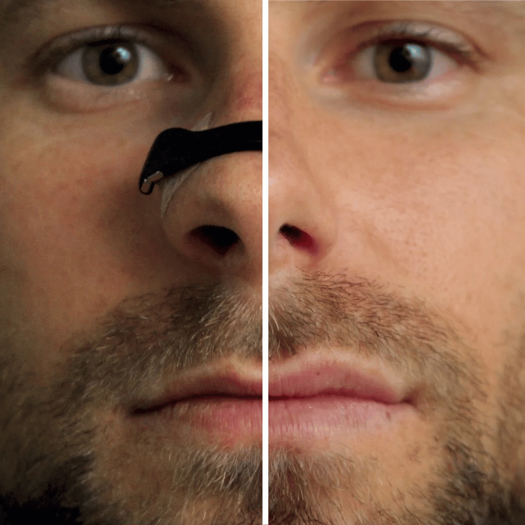 AirEase™ Magnetic Nasal Strip