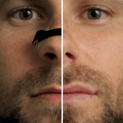 AirEase™ Magnetic Nasal Strip