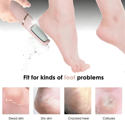 SilkFeet™ Electric Callus Remover