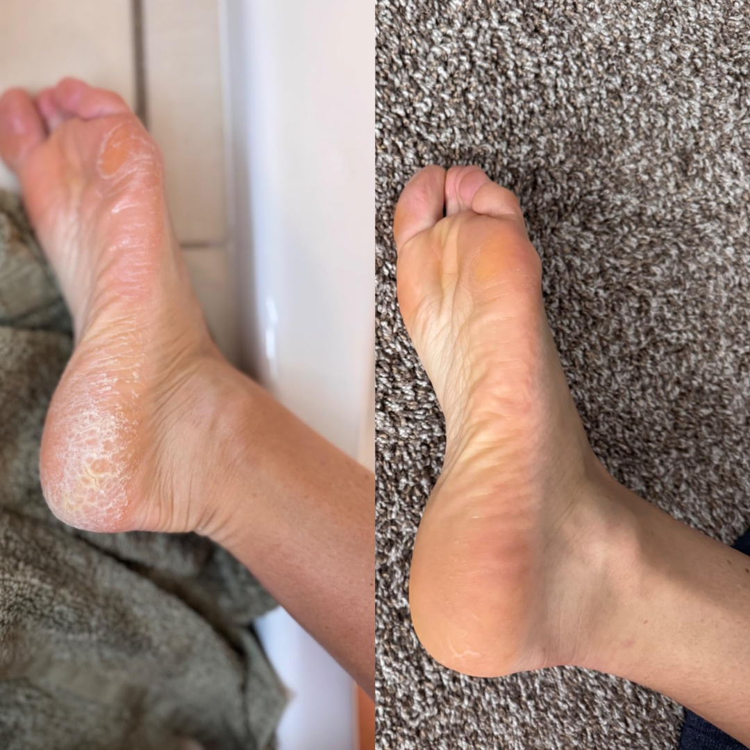 HeloSoft™ Gel Heel Socks