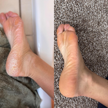 HeloSoft™ Gel Heel Socks