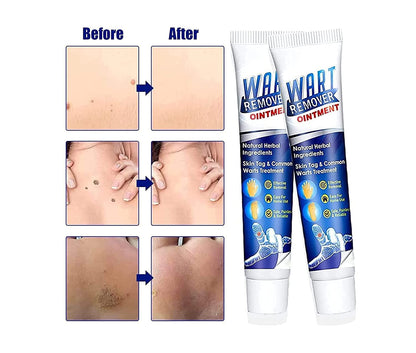 WART REMOVER (PACK OF 1)