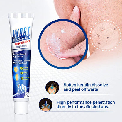 WART REMOVER (PACK OF 1)
